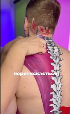 Головная боль